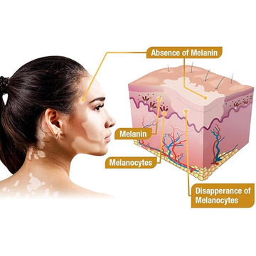 8524